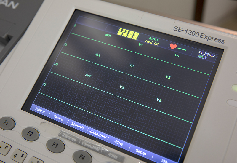 ECG